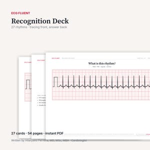 Puede incluir: El ECG Fluent Recognition Deck es un conjunto de 27 tarjetas con 54 páginas en formato PDF instantáneo. Cada tarjeta muestra un trazado de ritmo ECG negro sobre una cuadrícula roja, con el texto What is this rhythm? y detalles clínicos.