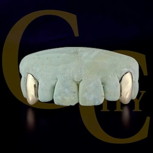 May include: A dental mold with two gold-colored tooth caps. The mold is a light green color and sits against a black background with gold-colored text and a logo.