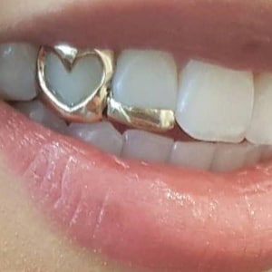 May include: Close-up of a mouth with a gold tooth cap in the shape of a heart. The adjacent tooth has a gold band. The lips are a natural pink color, and the teeth are white.