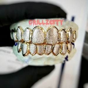 Custom Fitted Grillz White Gold | Yellow gold Diamond Dust Custom Grillz | 925 Silver with free mold kit and Free shipping by Grillzcity
