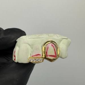 Custom Fit 2 Teeth Grillz in Real Gold or 925 SILVER window gillz VVS Moissanite on Tip Incisor Open face canine  with VVS Moissanite