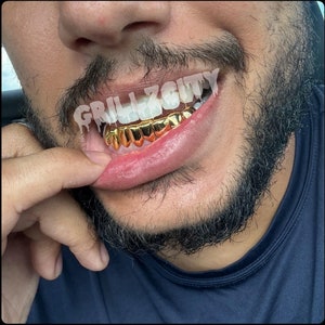 Massive Goldzähne Grillz / 925er Silber Grillz, Massivholz Grillz, Permanent Cut / Deep Cut Grillz mit freeform Kit und Versand inklusive / Schnelle Lieferung