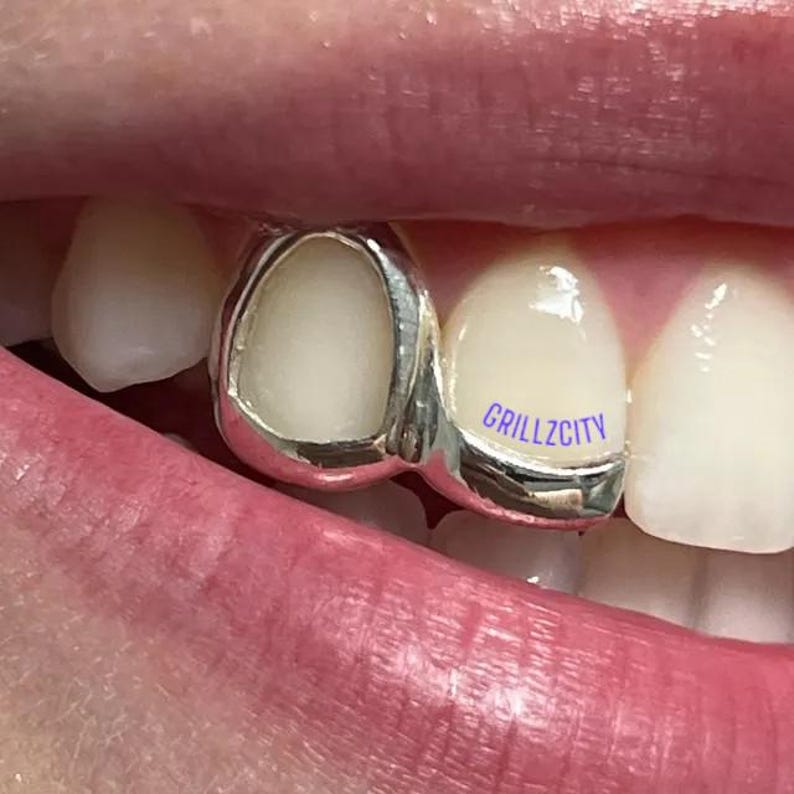 May include: Close-up of a silver tooth grill with the text "GRILLZCITY" in blue. The grill is on a tooth and is surrounded by other teeth and lips.
