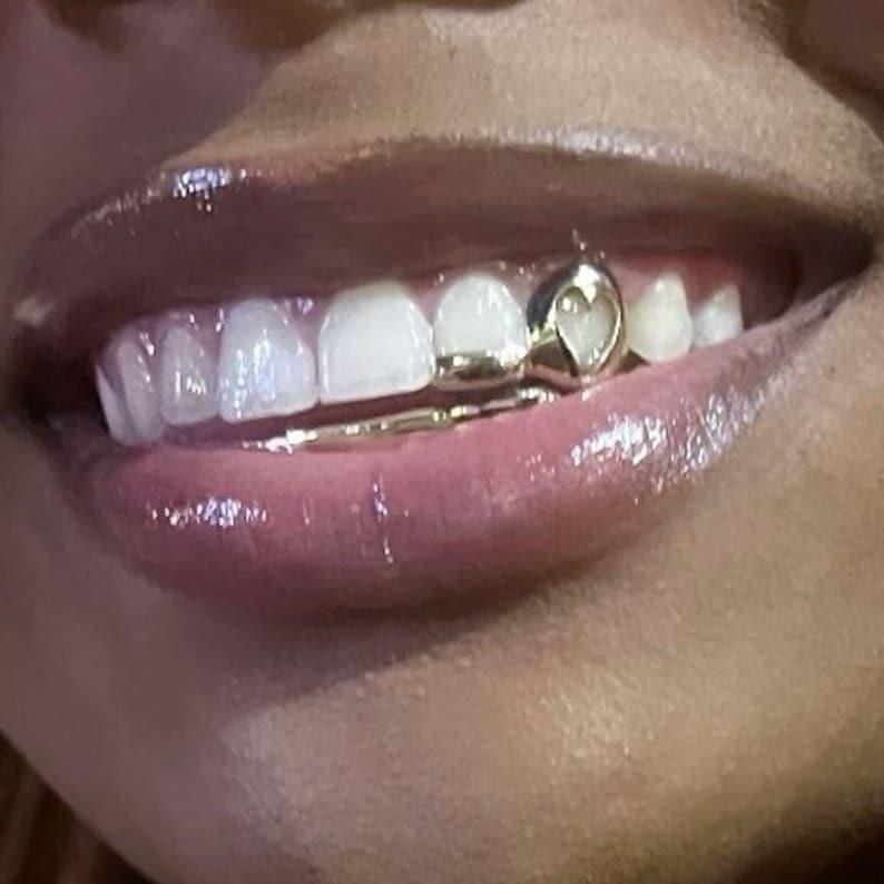 May include: Close-up of a person's mouth with a gold tooth grill. The grill features a heart-shaped design on the top tooth and a connecting bar. The lips are glossy and a light pink color.