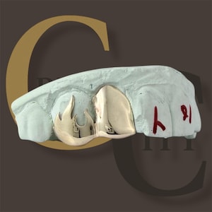 May include: A gold-coloured tooth grill with a flame design, set on a light blue dental mould. The grill covers two teeth and features a polished finish. Red markings are visible on the mould.