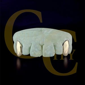 Custom Fit Grillz, 10k 14k 18k Gold or 925 Silver Canines Slugs, Back Bar, 2 teeth, ADD Vampire Fang: Free Mold Kit + Shipping