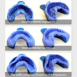 Mold kit for Custom Gold Grillz / Dental Teeth Impression / Grillz Mold Kit / Dental Use . 2 Kit each set for same price as One image 4