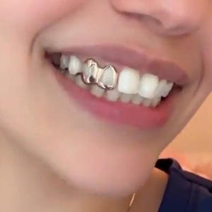 May include: A close-up of a person's smile, featuring a silver grill on the top front teeth. The grill reflects light, contrasting with the white teeth. The person's lips are slightly open, showing the teeth and the silver accessory.