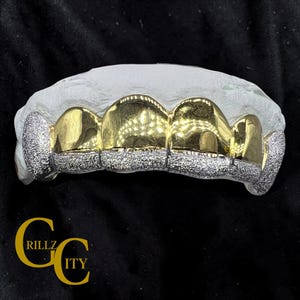 Custom Fit Grillz, 10k-18k Gold or 925 Silver, Diamond Dust Tips: Free Mold Kit
