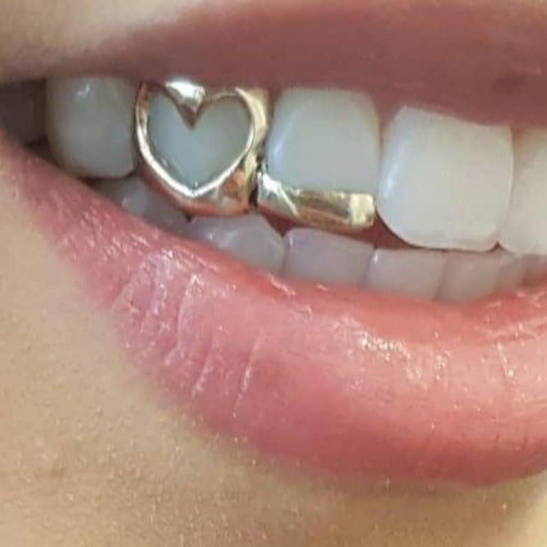 May include: Close-up of a mouth with a gold tooth cap in the shape of a heart. The adjacent tooth has a gold band. The lips are a natural pink color, and the teeth are white.