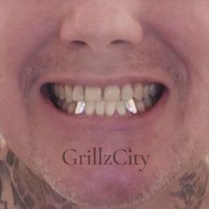 Custom Fit Grillz, 10k-18k Gold or 925 Silver Slug Canines, With Back Bar 2 Teeth: Includes Mold Kit. ADD Fangs For a Vampire look