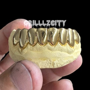 Custom solid Gold Grillz / 925 Silver Grillz , Permanent Cut / Deep Cut Grillz with free mold kit and shipping included / Fast turnaround image 2