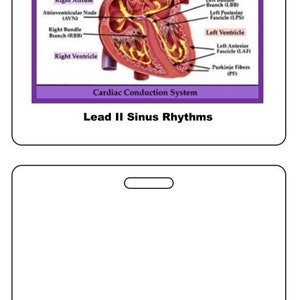 May include: A diagram of the cardiac conduction system with labels for the sinoatrial node, right atrium, atrioventricular node, right bundle branch, right ventricle, left atrium, HIS bundle, left bundle branch, left posterior fascicle, left ventricle, left anterior fascicle, and Purkinje fibers. The diagram is accompanied by a table titled "Characteristics of Sinus Rhythms" with columns for cardiac rhythm, rhythm character, rate, P waves, PR interval, and QRS. The table lists the characteristics of normal sinus rhythm, sinus bradycardia, and sinus tachycardia.