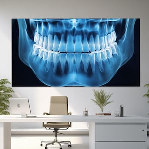 Dental X-Ray Canvas Print, Dental Wall Art, Orthodontist Gift, Orthodontist Clinic Decor, X-Ray Poster, Dentist Gift, Dentistry Print