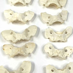 May include: Ten white anatomical vertebrae bones, likely from a human skeleton, arranged in a vertical row.