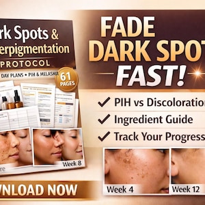 May include: An image of a book titled "Dark Spots & Hyperpigmentation Protocol" with before and after photos of skin. The cover includes text: "30 & 90 Day Plans" and "61 Pages". The image also includes the text "FADE DARK SPOTS FAST!" and "DOWNLOAD NOW".