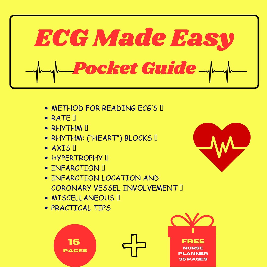 ECG Study Guide Interpretations Nursing Students Paramedics EKG ...