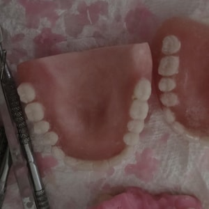 Puede incluir: Dos juegos de dentaduras postizas de acr&iacute;lico rosa con dientes blancos dispuestos sobre una superficie texturizada junto a herramientas dentales de metal. Las dentaduras presentan una base curva color enc&iacute;a con dientes blancos.