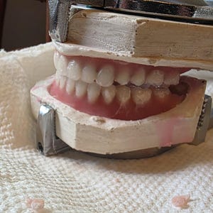 May include: A dental articulator holding a set of white prosthetic teeth set in pink acrylic gums. The device is constructed from metal and features plaster casts of the upper and lower dental arches, secured by a mechanical hinge mechanism.