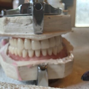 Puede incluir: Un modelo dental que presenta un conjunto de dientes prot&eacute;sicos blancos fijados en un material de color rosa enc&iacute;a, sostenido de forma segura dentro de un marco articulador de metal. La estructura consta de dos bloques de yeso alineados.