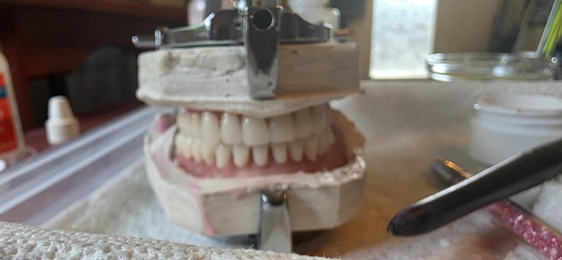 Puede incluir: Un modelo dental que presenta un conjunto de dientes prot&eacute;sicos blancos fijados en un material de color rosa enc&iacute;a, sostenido de forma segura dentro de un marco articulador de metal. La estructura consta de dos bloques de yeso alineados.