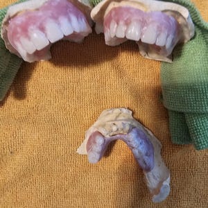 Puede incluir: Dos pr&oacute;tesis dentales superiores con bases de acr&iacute;lico rosa y dientes blancos, situadas sobre una pr&oacute;tesis dental inferior con base rosa y dientes visibles, todo sobre una superficie texturizada con un elemento de tela verde.