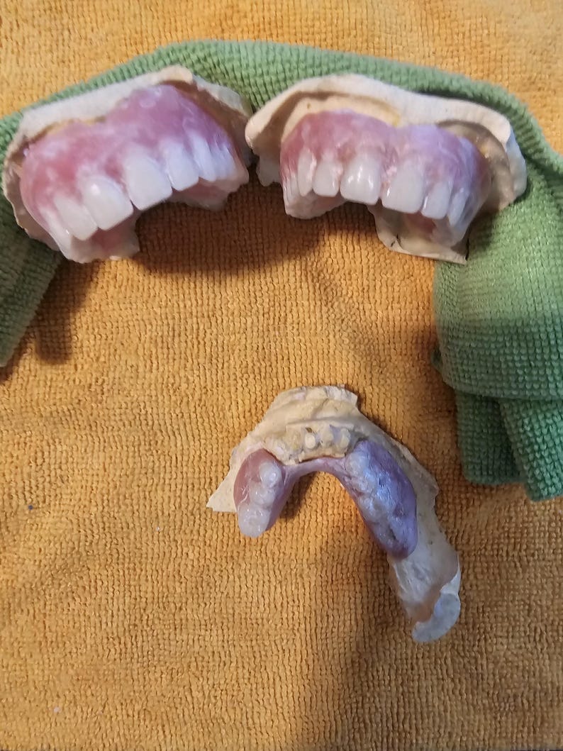Puede incluir: Dos pr&oacute;tesis dentales superiores con bases de acr&iacute;lico rosa y dientes blancos, situadas sobre una pr&oacute;tesis dental inferior con base rosa y dientes visibles, todo sobre una superficie texturizada con un elemento de tela verde.