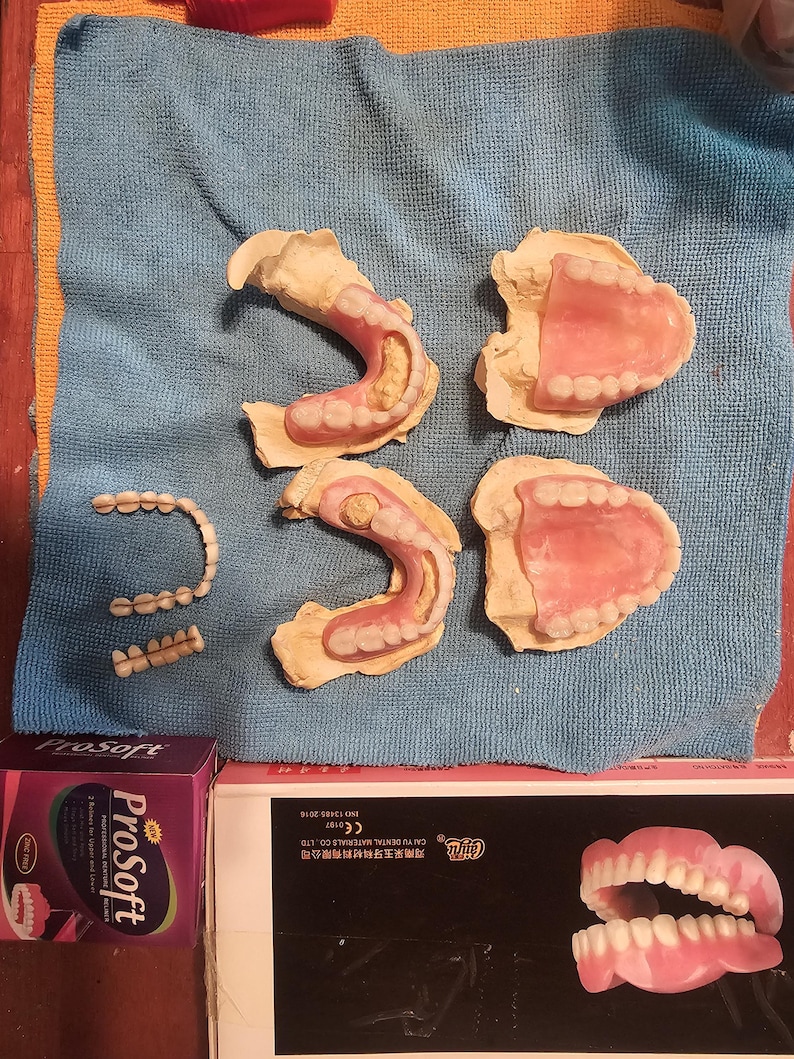Puede incluir: Una colecci&oacute;n de pr&oacute;tesis dentales que incluye cuatro dentaduras parciales y completas fijadas en moldes de yeso, dos segmentos de puente dental separados y dos cajas de productos etiquetadas Prosoft y Cai Yu Dental Materials Co., Ltd. con un modelo.