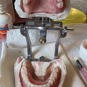 Puede incluir: Un articulador dental que sostiene moldes dentales de yeso superior e inferior con dentaduras postizas de acr&iacute;lico rosa integradas. El marco de metal cuenta con un mecanismo de tornillo central que conecta los dos modelos de yeso.