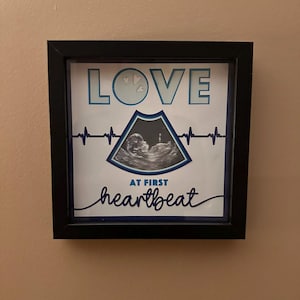 Op de afbeelding: Een zwart ingelijst beeld met een witte achtergrond. De afbeelding heeft een blauwe en witte echografie met de tekst "LOVE" bovenaan en "AT FIRST heartbeat" onderaan.