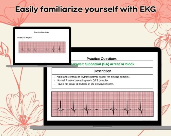 ECG/ EKG Flashcards, EKG Interpretation up to 100 Flashcards - Etsy