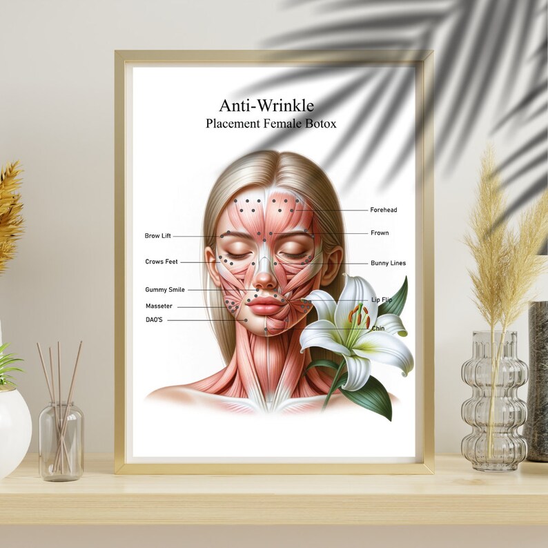 Facial Anatomy Art, Face Anatomy Poster, Facial Filler, Facial Muscles