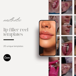 Luxury Lip Filler Instagram Video Reel Templates , Nurse Injector Reels, Lip Injection Reels Template, Lip Filler Social Media, Medspa Reels