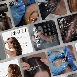 May include: A collection of social media graphics for a scalp micropigmentation business. The graphics feature images of people with hair, a price list, and information about the procedure. The text "Did you know?" is featured in a speech bubble.