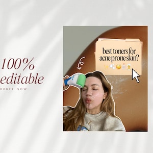 May include: A digital graphic featuring the text 100% editable and order now. It displays a person using a blue and green facial ice roller on their face, with a digital folder icon containing the text best toners for acne prone skin? and emojis.