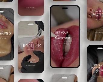 Luxury Lip Filler Instagram Video Reel Templates , Nurse Injector Reels, Lip Injection Reels Template, Lip Filler Social Media, Medspa Reels