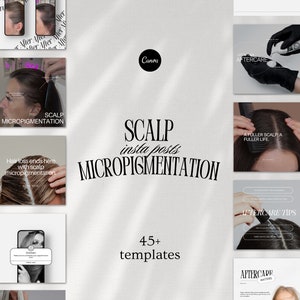 Scalp Micropigmentation Instagram Post Templates, PMU and SMP Social Media, Hair Tattooing Posts, Paramedical Tattoo, Editable Canva Posts