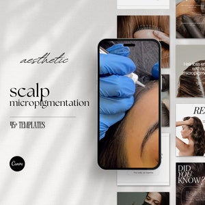 Scalp Micropigmentation Instagram Post Templates, PMU and SMP Social Media, Hair Tattooing Posts, Paramedical Tattoo, Editable Canva Posts