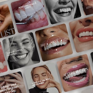 Teeth Whitening Instagram Post Templates, Canva Dentist Flyer Template, LED teeth Whitening Posts, Tooth Gem Instagram, Teeth Whitening Post