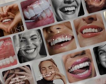 Teeth Whitening Instagram Post Templates, Canva Dentist Flyer Template, LED teeth Whitening Posts, Tooth Gem Instagram, Teeth Whitening Post