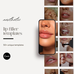 Plantillas de Instagram de lujo sobre rellenos de labios y botox, publicaciones en redes sociales de enfermeras estéticas e inyectoras de labios, publicaciones sobre rellenos de labios, marca de Instagram de Medspa