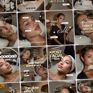 Puede incluir: Una cuadrícula de publicaciones en redes sociales que muestra a una persona recibiendo tratamientos faciales. Las imágenes incluyen superposiciones de texto como bestselling facials, dermaplaning, meet the esti, dead skin hates to see me coming, post facial y the glow effect.