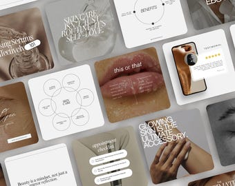 Aesthetic Beauty Social Media Templates | Botox & Filler Instagram Posts | Luxury Esthetician Template | Aesthetic Beauty Posts | Canva