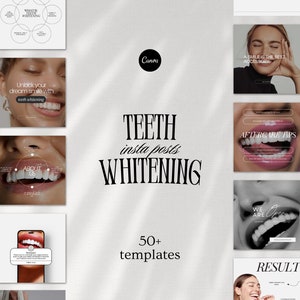 Teeth Whitening Instagram Post Templates, Canva Dentist Flyer Template, LED teeth Whitening Posts, Tooth Gem Instagram, Teeth Whitening Post