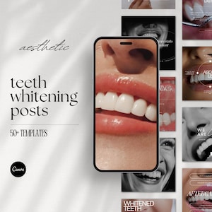 Teeth Whitening Instagram Post Templates, Canva Dentist Flyer Template, LED teeth Whitening Posts, Tooth Gem Instagram, Teeth Whitening Post