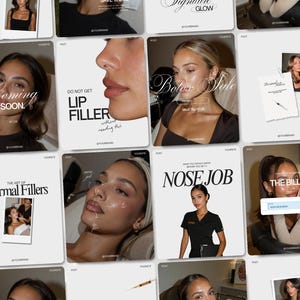 Botox-Filler-Instagram-Vorlagen für ästhetische Medizin-Spas, Social-Media-Branding, virale Beiträge von Krankenschwestern, die Injektionen durchführen, Luxus-Lippenfiller-Canva-Post-Bundle