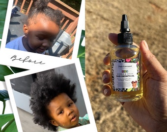 Baby & Toddler Hair Growth Oil | Hair Growth Oil | Fast Growth Herbal Hair Growth Oil