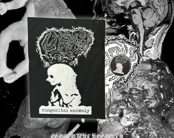May include: Black and white patch featuring a graphic of a foetus with a brain-like object above its head. The text "congenital anomaly" is printed below the graphic. The patch is on a black background.
