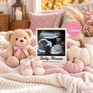 Peut inclure: Un ours en peluche beige avec un ruban rose, une paire de chaussons pour bébé en tricot crème avec des nœuds roses, et un panneau rectangulaire blanc avec une échographie en noir et blanc, le texte Baby Mirana et DUE NOVEMBER 202X.