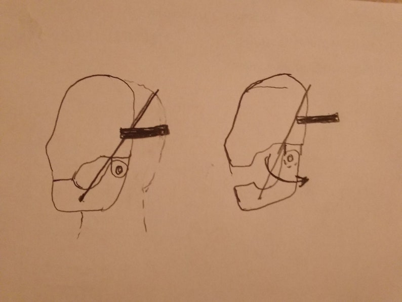 May include: A hand-drawn illustration of two different views of a human skull with a strap across the forehead. The strap is shown in two different positions.